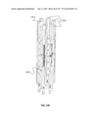 Actively Controllable Stent, Stent Graft, Heart Valve and Method of     Controlling Same diagram and image