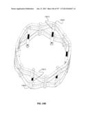 Actively Controllable Stent, Stent Graft, Heart Valve and Method of     Controlling Same diagram and image