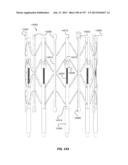 Actively Controllable Stent, Stent Graft, Heart Valve and Method of     Controlling Same diagram and image