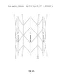 Actively Controllable Stent, Stent Graft, Heart Valve and Method of     Controlling Same diagram and image