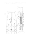 Actively Controllable Stent, Stent Graft, Heart Valve and Method of     Controlling Same diagram and image