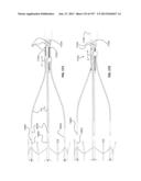 Actively Controllable Stent, Stent Graft, Heart Valve and Method of     Controlling Same diagram and image