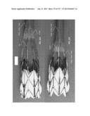 Actively Controllable Stent, Stent Graft, Heart Valve and Method of     Controlling Same diagram and image