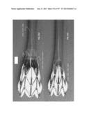 Actively Controllable Stent, Stent Graft, Heart Valve and Method of     Controlling Same diagram and image