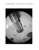 Actively Controllable Stent, Stent Graft, Heart Valve and Method of     Controlling Same diagram and image