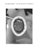 Actively Controllable Stent, Stent Graft, Heart Valve and Method of     Controlling Same diagram and image