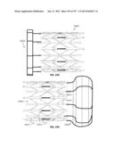 Actively Controllable Stent, Stent Graft, Heart Valve and Method of     Controlling Same diagram and image