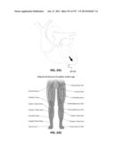 Actively Controllable Stent, Stent Graft, Heart Valve and Method of     Controlling Same diagram and image