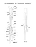 Actively Controllable Stent, Stent Graft, Heart Valve and Method of     Controlling Same diagram and image