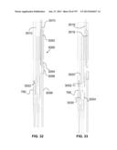 Actively Controllable Stent, Stent Graft, Heart Valve and Method of     Controlling Same diagram and image