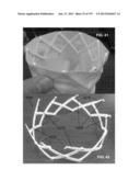 Actively Controllable Stent, Stent Graft, Heart Valve and Method of     Controlling Same diagram and image