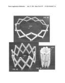 Actively Controllable Stent, Stent Graft, Heart Valve and Method of     Controlling Same diagram and image