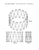 Actively Controllable Stent, Stent Graft, Heart Valve and Method of     Controlling Same diagram and image