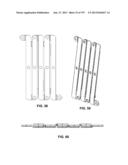 Actively Controllable Stent, Stent Graft, Heart Valve and Method of     Controlling Same diagram and image