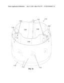 Actively Controllable Stent, Stent Graft, Heart Valve and Method of     Controlling Same diagram and image