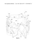 Actively Controllable Stent, Stent Graft, Heart Valve and Method of     Controlling Same diagram and image