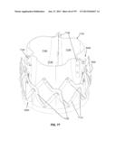 Actively Controllable Stent, Stent Graft, Heart Valve and Method of     Controlling Same diagram and image