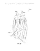 Actively Controllable Stent, Stent Graft, Heart Valve and Method of     Controlling Same diagram and image