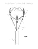 Actively Controllable Stent, Stent Graft, Heart Valve and Method of     Controlling Same diagram and image