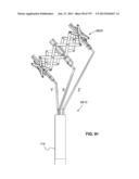 Actively Controllable Stent, Stent Graft, Heart Valve and Method of     Controlling Same diagram and image