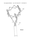 Actively Controllable Stent, Stent Graft, Heart Valve and Method of     Controlling Same diagram and image