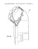 Actively Controllable Stent, Stent Graft, Heart Valve and Method of     Controlling Same diagram and image