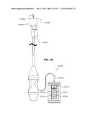 Actively Controllable Stent, Stent Graft, Heart Valve and Method of     Controlling Same diagram and image