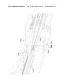 Actively Controllable Stent, Stent Graft, Heart Valve and Method of     Controlling Same diagram and image