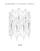 Actively Controllable Stent, Stent Graft, Heart Valve and Method of     Controlling Same diagram and image