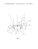 Heart Valve Assemblies and methods for using them diagram and image