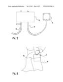 Heel Protection Device diagram and image