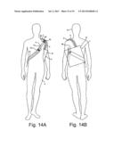 SLING BAG WITH STRAP FASTENING ARRANGEMENT diagram and image