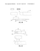 Safety Barrier Netting System diagram and image