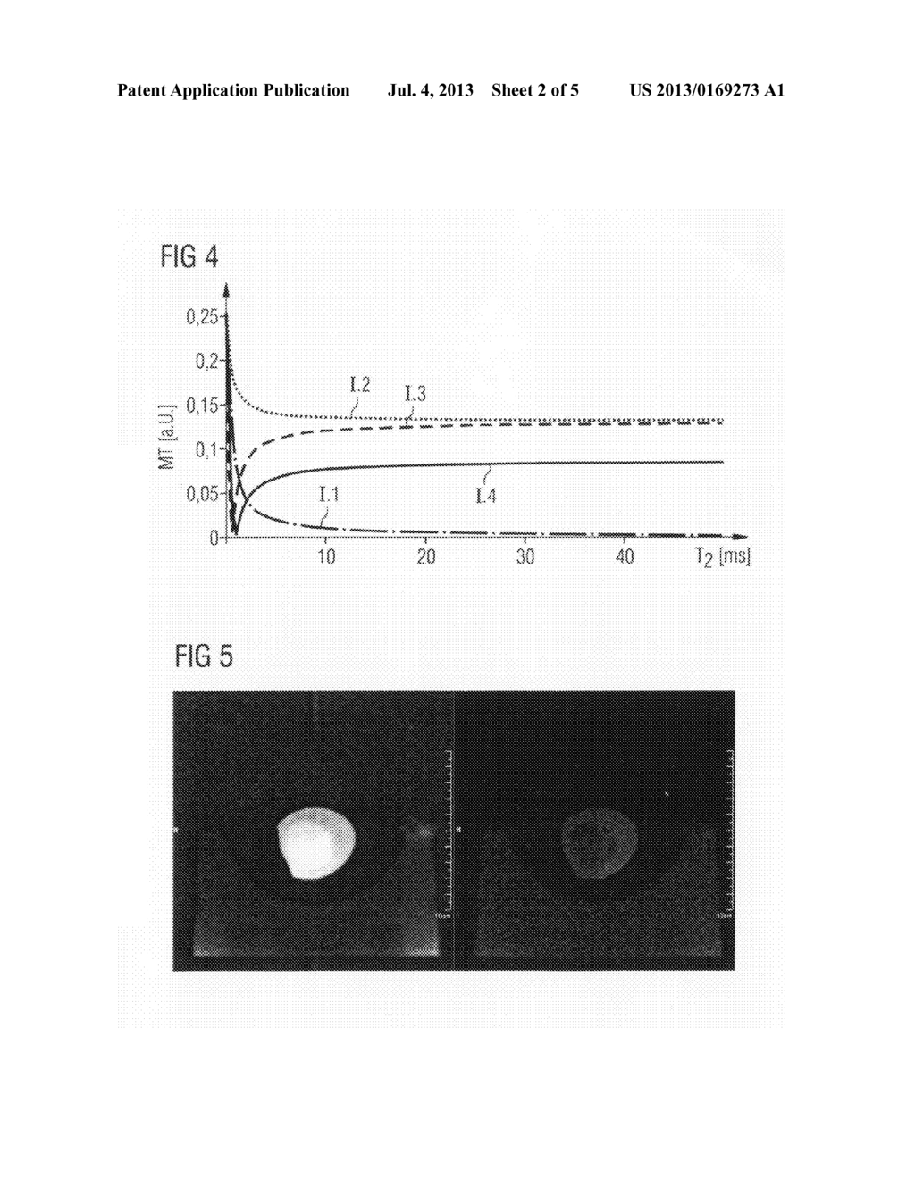 MAGNETIC RESONANCE SYSTEM, OPERATING METHOD AND CONTROL DEVICE TO GENERATE     T2-WEIGHTED IMAGES USING A PULSE SEQUENCE WITH VERY SHORT ECHO TIMES - diagram, schematic, and image 03