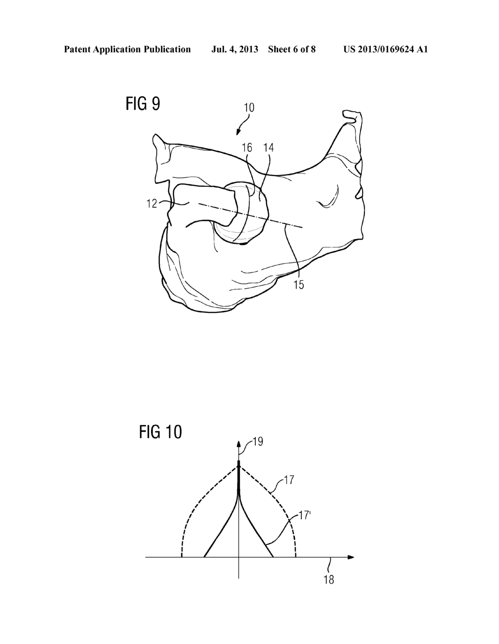 METHOD FOR VISUALIZING THE QUALITY OF AN ABLATION PROCESS - diagram, schematic, and image 07