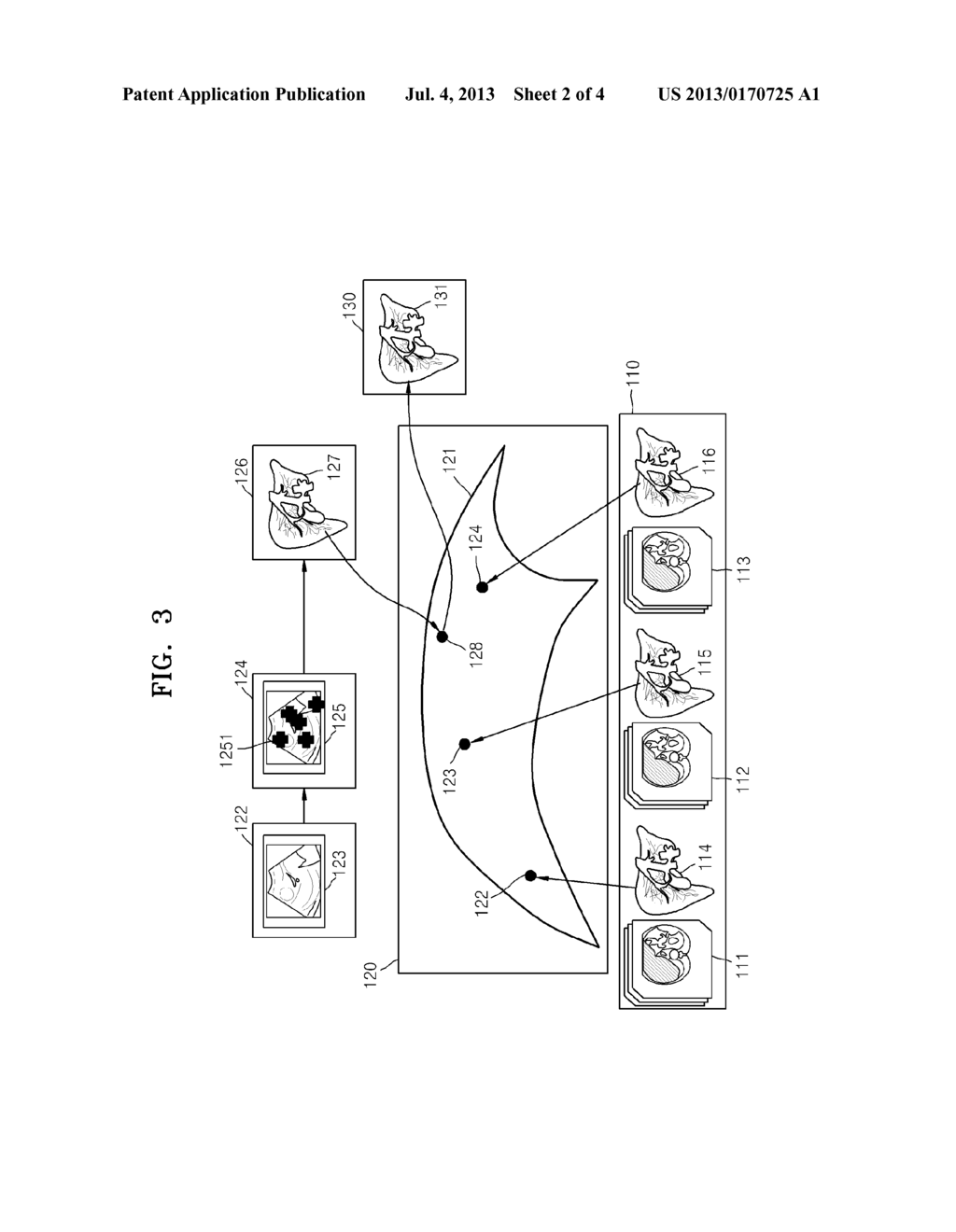 METHOD AND APPARATUS FOR ESTIMATING ORGAN DEFORMATION MODEL AND MEDICAL     IMAGE SYSTEM - diagram, schematic, and image 03