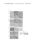 COMPOSITION FOR REGENERATING NORMAL TISSUE FROM FIBROTIC TISSUE diagram and image