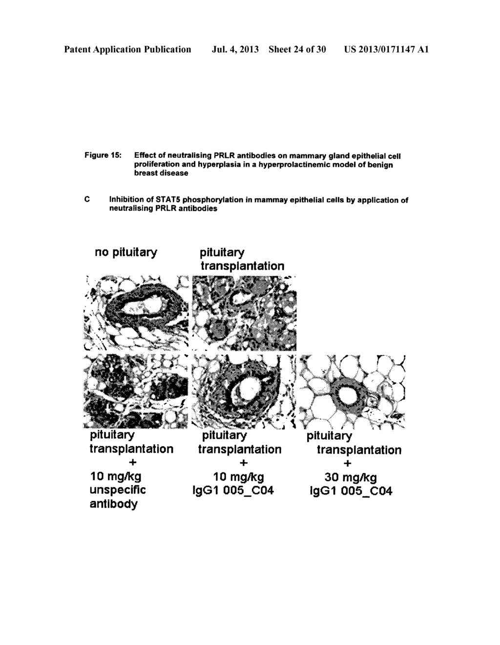 NEUTRALIZING PROLACTIN RECEPTOR ANTIBODIES AND THEIR THERAPEUTIC USE - diagram, schematic, and image 25