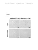 Galacto-rhamnogalacturonate compositions for the treatment of     non-alcoholic steatohepatitis and non-alcoholic fatty liver disease diagram and image