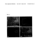 Inhibition of LAR Phosphatase to Enhance Therapeutic Angiogenesis diagram and image