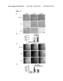 Inhibition of LAR Phosphatase to Enhance Therapeutic Angiogenesis diagram and image