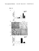 Inhibition of LAR Phosphatase to Enhance Therapeutic Angiogenesis diagram and image