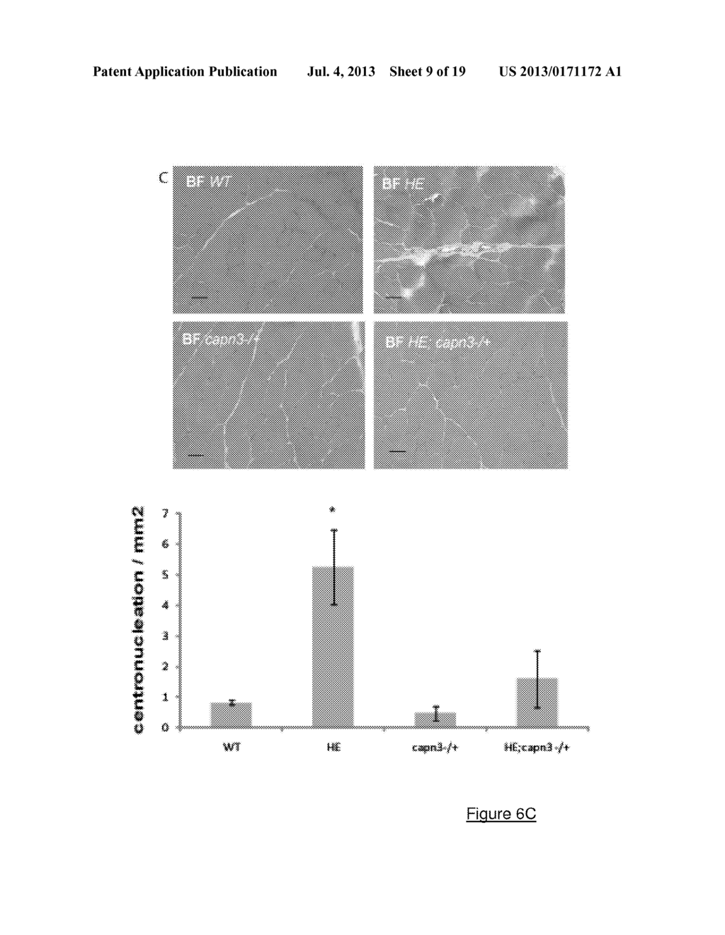 CALPAIN-3 INHIBITORS FOR TREATING MUSCULAR DYSTROPHIES AND     CARDIOMYOPATHIES - diagram, schematic, and image 10