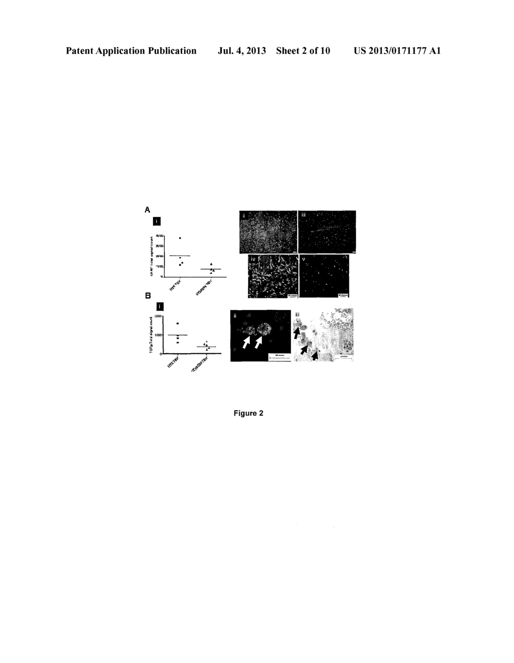 Therapeutic Use of Neural Stem Cells - diagram, schematic, and image 03