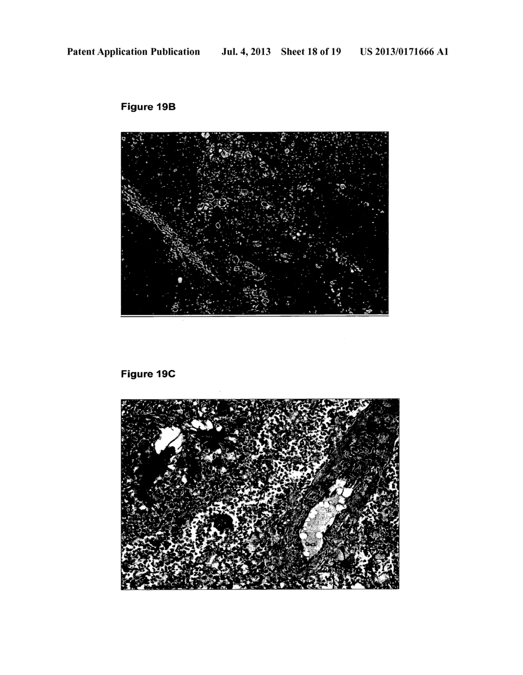 Purinergic (P2X) Receptors in Extra-Cellular Body Fluid - diagram, schematic, and image 19