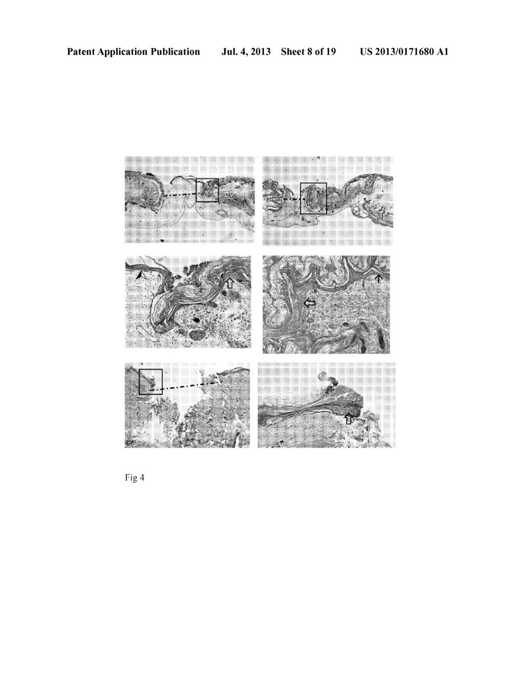 CHIMERIC AVIAN-BASED SCREENING SYSTEM CONTAINING MAMMALIAN GRAFTS - diagram, schematic, and image 09