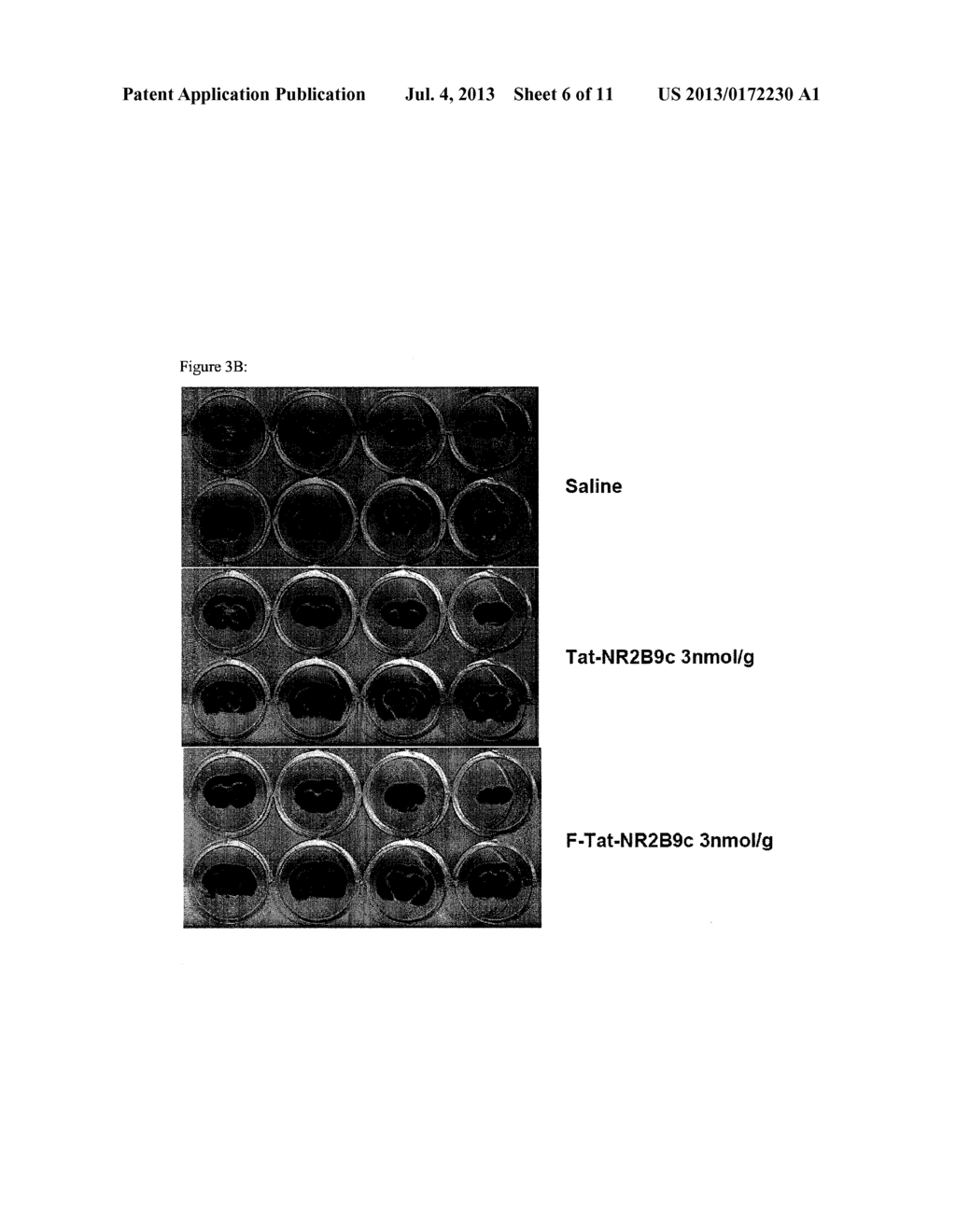 Treating Stroke and Other Diseases Without Inhibiting N-Type Calcium     Channels - diagram, schematic, and image 07