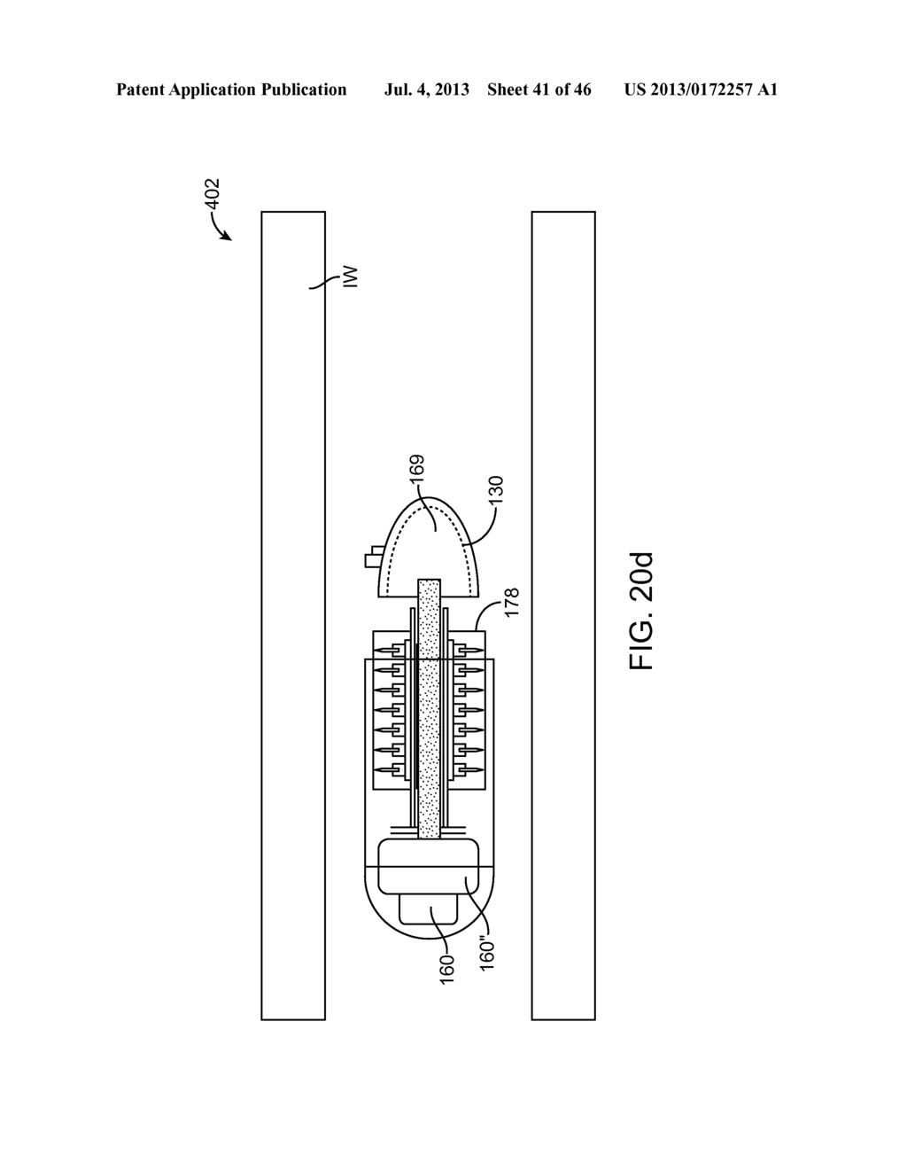 THERAPEUTIC AGENT PREPARATIONS FOR DELIVERY INTO A LUMEN OF THE INTESTINAL     TRACT USING A SWALLOWABLE DRUG DELIVERY DEVICE - diagram, schematic, and image 42