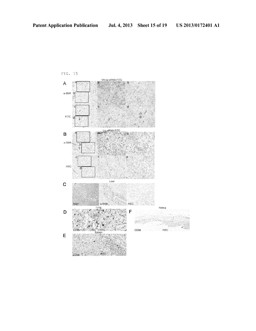 COMPOSITION FOR REGENERATING NORMAL TISSUE FROM FIBROTIC TISSUE - diagram, schematic, and image 16