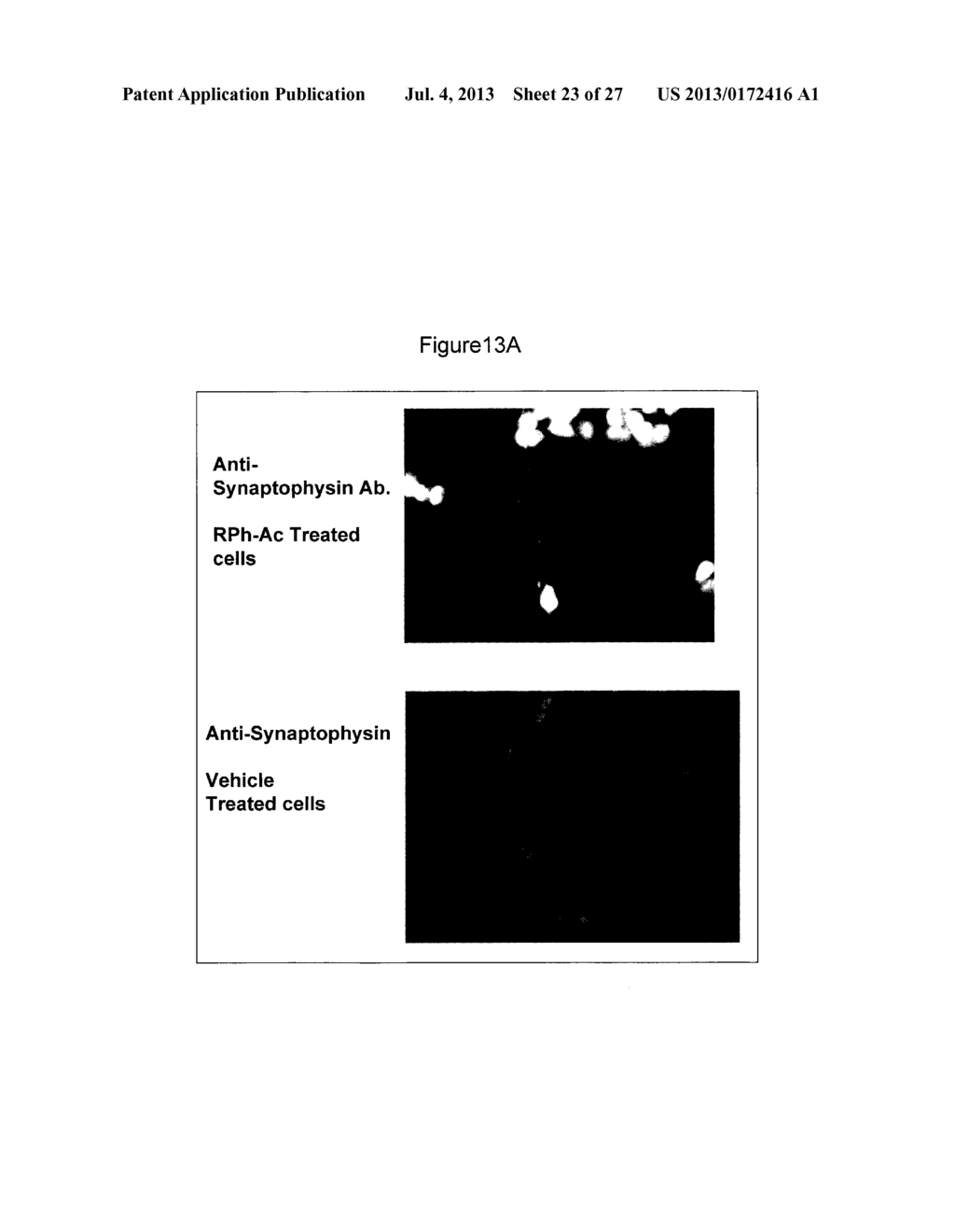 COMPOSITIONS COMPRISING ACIDIC EXTRACTS OF MASTIC GUM - diagram, schematic, and image 24